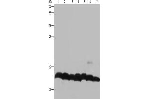 Western Blotting (WB) image for anti-Histone H4 antibody (ABIN2423580) (Histone H4 antibody)
