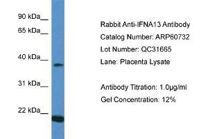 Western Blotting (WB) image for anti-Interferon, alpha 13 (IFNA13) (C-Term) antibody (ABIN2788553) (IFNA13 antibody  (C-Term))