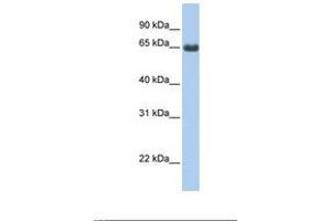 Image no. 1 for anti-Fem-1 Homolog B (FEM1B) (C-Term) antibody (ABIN6738885) (FEM1B antibody  (C-Term))