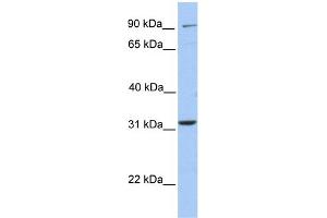 WB Suggested Anti-ELFN2 Antibody Titration:  0. (ELFN2 antibody  (N-Term))