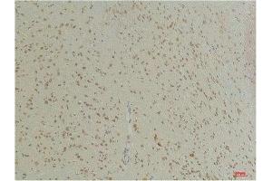 Immunohistochemical analysis of paraffin-embedded Mouse BrainTissue using GABA Transporter 1 Rabbit pAb diluted at 1:200.