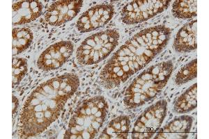 Immunoperoxidase of monoclonal antibody to NDUFS4 on formalin-fixed paraffin-embedded human colon. (NDUFS4 antibody  (AA 66-175))