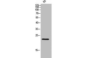 Western Blot analysis of KB cells using Lambda 5 Polyclonal Antibody (IGLL1 antibody  (C-Term))