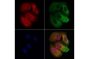ABIN7093832 and ABIN7097875 staining Hela cells by IF/ICC. (BBS9 antibody  (C-Term))