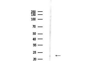 anti-Opa Interacting Protein 5 (OIP5) (C-Term) antibody