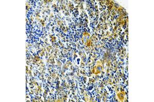 Immunohistochemistry of paraffin-embedded mouse spleen using GLRX Antibody (ABIN5973060) at dilution of 1/200 (40x lens). (Glutaredoxin 1 antibody)