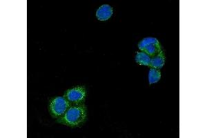 IF analysis of USP21 using anti-USP21 antibody (ABIN7601053).