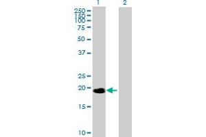 Western Blot analysis of NME6 expression in transfected 293T cell line by NME6 MaxPab polyclonal antibody.