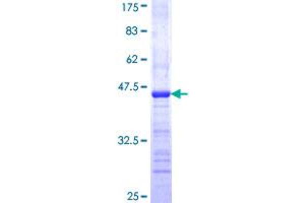 MAGI1 Protein (AA 761-859) (GST tag)