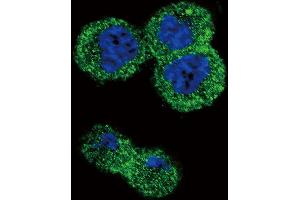 Confocal immunofluorescent analysis of AKT1 Antibody (N-term) h with MDA-M cell followed by Alexa Fluor 488-conjugated goat anti-rabbit lgG (green). (AKT1 antibody  (N-Term))