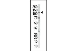 The anti-FGFR1 Pab (ABIN1882081 and ABIN2841755) is used in Western blot to detect FGFR1 in NIH-3T3 cell lysate. (FGFR1 antibody  (N-Term))