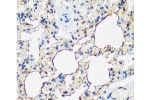 Immunohistochemistry of paraffin-embedded Rat lung using ALOX15 Polyclonal Antibody at dilution of 1:200 (40x lens). (ALOX15 antibody)