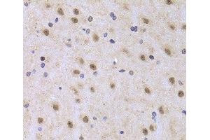 Immunohistochemistry of paraffin-embedded Rat brain using ILF2 Polyclonal Antibody at dilution of 1:100 (40x lens). (ILF2 antibody)