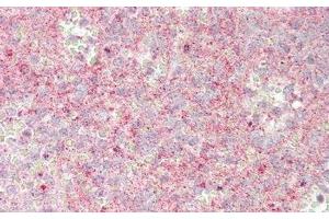 Detection of JAG1 in Human Spleen Tissue using Polyclonal Antibody to Jagged 1 (JAG1) (JAG1 antibody  (AA 33-250))