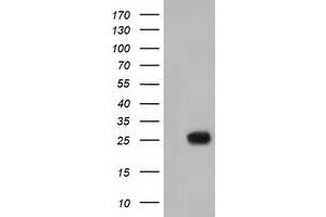 HEK293T cells were transfected with the pCMV6-ENTRY control (Left lane) or pCMV6-ENTRY MOBKL2B (Right lane) cDNA for 48 hrs and lysed. (MOBKL2B antibody)