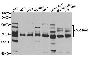 Western blot analysis of extracts of various cells, using SLC20A1 antibody. (SLC20A1 antibody)