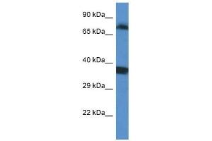 Western Blot showing SRPK1 antibody used at a concentration of 1 ug/ml against Fetal Lung Lysate (SRPK1 antibody  (C-Term))