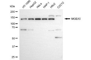 anti-Meningioma Expressed Antigen 5 (Hyaluronidase) (MGEA5) antibody