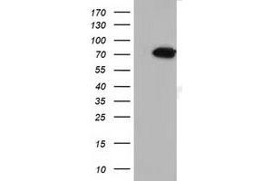 MTMR14 antibody