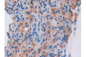 Used in DAB staining on fromalin fixed paraffin- embedded heart tissue (AGRP antibody  (AA 21-131))