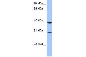 WB Suggested Anti-JAZF1 Antibody Titration:  0. (JAZF1 antibody  (C-Term))