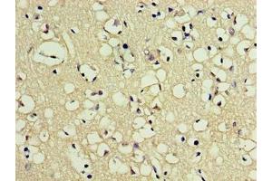 Immunohistochemistry of paraffin-embedded human brain tissue using ABIN7162631 at dilution of 1:100 (PNMA5 antibody  (AA 4-442))