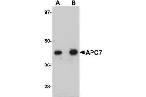 Western blot analysis of APC7 in rat kidney tissue lysate with AP30063PU-N APC7 antibody at (A) 1 and (B) 2 μg/ml. (ANAPC7 antibody  (C-Term))