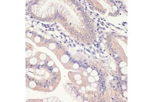 Immunohistochemistry of paraffin-embedded human small intestine using HMGCR antibody (ABIN3022293, ABIN3022294, ABIN3022295, ABIN1513022 and ABIN6218714) at dilution of 1:200 (40x lens). (HMGCR antibody  (AA 629-888))