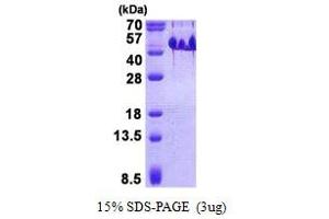 Image no. 1 for Brain Abundant, Membrane Attached Signal Protein 1 (BASP1) protein (His tag) (ABIN1098536)