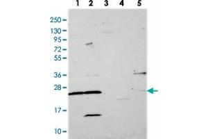 Western blot analysis of Lane 1: RT-4, Lane 2: U-251 MG, Lane 3: Human Plasma, Lane 4: Liver, Lane 5: Tonsil with MRPS26 polyclonal antibody  at 1:250-1:500 dilution. (MRPS26 antibody)