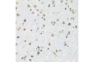 Immunohistochemistry (Paraffin-embedded Sections) (IHC (p)) image for anti-Splicing Factor Proline/glutamine-Ric (SFPQ) (AA 578-707) antibody (ABIN1513519)