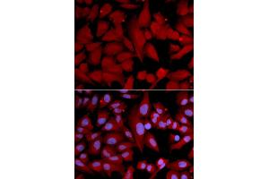 Immunofluorescence analysis of U2OS cells using PSMA4 antibody (ABIN5971344). (PSMA4 antibody)
