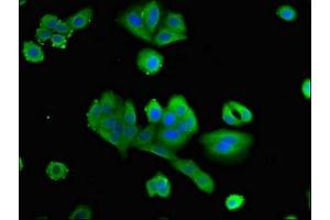 Immunofluorescent analysis of HepG2 cells using ABIN7162750 at dilution of 1:100 and Alexa Fluor 488-congugated AffiniPure Goat Anti-Rabbit IgG(H+L) (PTX3 antibody  (AA 99-164))