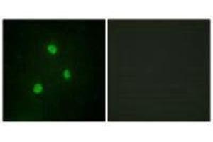 Immunofluorescence analysis of A549 cells, using TBX1 antibody. (T-Box 1 antibody  (C-Term))