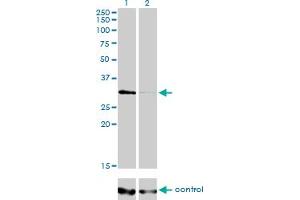 Western blot analysis of HDAC7A over-expressed 293 cell line, cotransfected with HDAC7A Validated Chimera RNAi (Lane 2) or non-transfected control (Lane 1). (HDAC7 antibody  (AA 1-276))