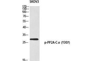 Western Blot (WB) analysis of SKOV3 using p-PP2A-Calpha (Y307) antibody.