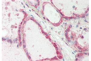 Rabbit Anti-ATE1 antibody  Formalin Fixed Paraffin Embedded Tissue: Human Thyroid Primary antibody Concentration: 1:100 Secondary Antibody: Donkey anti-Rabbit-Cy3 Secondary Antibody Concentration: 1:200 Magnification: 20x Exposure Time: 0. (ATE1 antibody  (Middle Region))