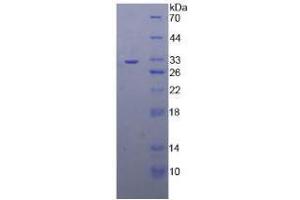 SDS-PAGE analysis of Human TRAF4 Protein.