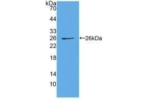 Detection of Recombinant CX43, Human using Polyclonal Antibody to Connexin 43 (CX43) (Connexin 43/GJA1 antibody  (AA 244-382))