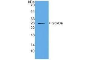 Detection of Recombinant CX43, Human using Polyclonal Antibody to Connexin 43 (CX43) (Connexin 43/GJA1 antibody  (AA 244-382))
