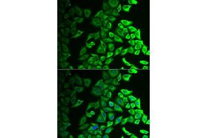 Immunofluorescence analysis of A549 cells using IL18BP antibody (ABIN5973845). (IL18BP antibody)