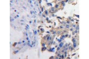 Used in DAB staining on fromalin fixed paraffin-embedded ovary tissue (PDGFD antibody  (AA 19-370))