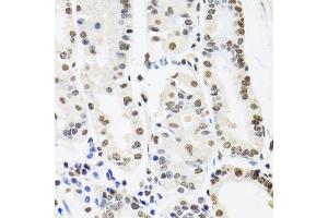 Immunohistochemistry (Paraffin-embedded Sections) (IHC (p)) image for anti-Splicing Factor Proline/glutamine-Ric (SFPQ) (AA 578-707) antibody (ABIN1513519)