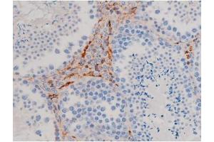 ABIN6267471 at 1/200 staining Mouse testis tissue sections by IHC-P. (AKT1 antibody  (pSer124))