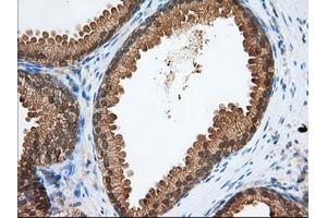 Immunohistochemical staining of paraffin-embedded Human pancreas tissue using anti-PDE4A mouse monoclonal antibody. (PDE4A antibody)
