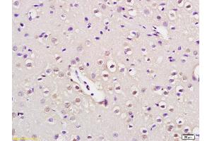 Formalin-fixed and paraffin embedded rat brain labeled with Anti-NUP50 Polyclonal Antibody, Unconjugated (ABIN873330) at 1:200 followed by conjugation to the secondary antibody and DAB staining (NUP50 antibody  (AA 351-450))