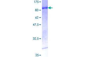 Image no. 1 for Retinoic Acid Receptor, gamma (RARG) (AA 1-454) protein (GST tag) (ABIN1317441) (Retinoic Acid Receptor gamma Protein (AA 1-454) (GST tag))