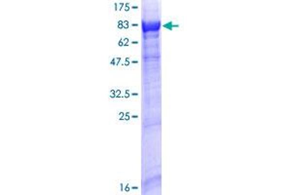 RABGGTA Protein (AA 1-567) (GST tag)