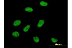 Immunofluorescence of purified MaxPab antibody to AOF2 on HeLa cell. (LSD1 antibody  (AA 1-876))