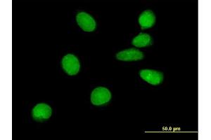 Immunofluorescence of purified MaxPab antibody to ASCIZ on HeLa cell.